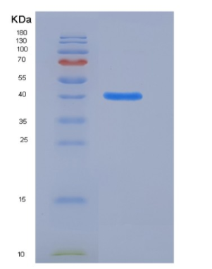 Recombinant Mouse HDAC8 / HDACL1 Protein (His tag),Recombinant Mouse HDAC8 / HDACL1 Protein (His tag)