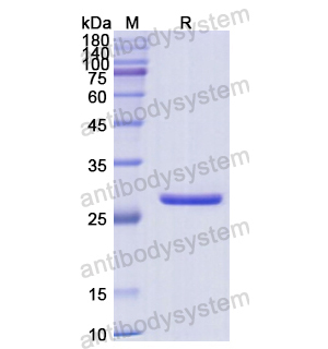 重组CLTB蛋白,Recombinant Human CLTB, N-His