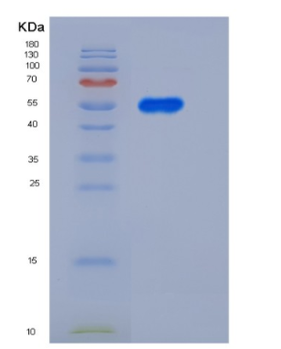Recombinant Rat PNLIPRP1 / PLRP1 Protein (His Tag),Recombinant Rat PNLIPRP1 / PLRP1 Protein (His Tag)