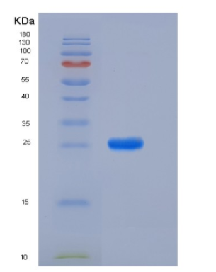 Recombinant Rat PRL8A4 Protein (His Tag),Recombinant Rat PRL8A4 Protein (His Tag)