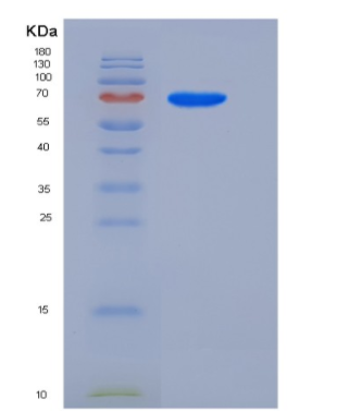 Recombinant Human Semaphorin 6A / SEMA6A Protein (His tag),Recombinant Human Semaphorin 6A / SEMA6A Protein (His tag)