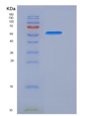 Recombinant Human AKT1 / PKB / PKBα Protein (His tag),Recombinant Human AKT1 / PKB / PKBα Protein (His tag)