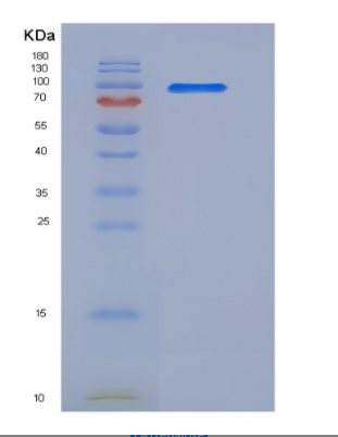 Recombinant Human SRPK1 Protein (His & GST tag),Recombinant Human SRPK1 Protein (His & GST tag)