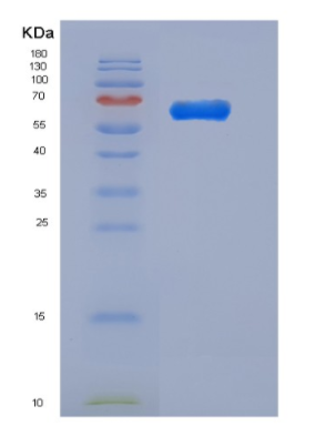 Recombinant Mouse PGRL / IGSF8 Protein (His tag),Recombinant Mouse PGRL / IGSF8 Protein (His tag)