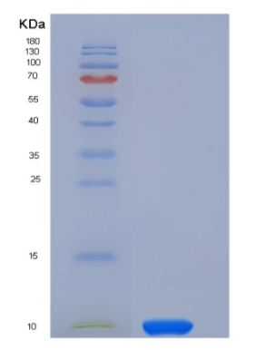 Recombinant Human COL6A3 / Collagen-VI Protein,Recombinant Human COL6A3 / Collagen-VI Protein