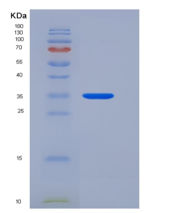 Recombinant Human ANXA5 / Annexin Ⅴ / Annexin A5 Protein,Recombinant Human ANXA5 / Annexin Ⅴ / Annexin A5 Protein