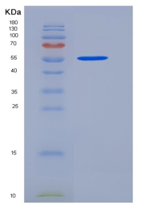 Recombinant Human Alkaline Phosphatase / ALPL Protein (His tag),Recombinant Human Alkaline Phosphatase / ALPL Protein (His tag)