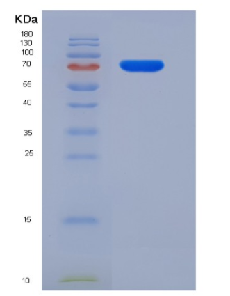 Recombinant Mouse SCARB1 / CD36L1 / CLA-1 Protein (His & Fc tag),Recombinant Mouse SCARB1 / CD36L1 / CLA-1 Protein (His & Fc tag)