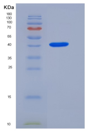 Recombinant Mouse Prostatic Acid Phosphatase / ACPP Protein (His tag),Recombinant Mouse Prostatic Acid Phosphatase / ACPP Protein (His tag)