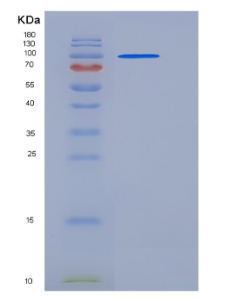 Recombinant Mouse ACO2 / Aconitase 2 Protein (His & GST tag),Recombinant Mouse ACO2 / Aconitase 2 Protein (His & GST tag)