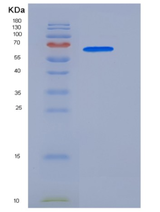 Recombinant Human p38 delta / MAPK13 Protein (GST tag),Recombinant Human p38 delta / MAPK13 Protein (GST tag)