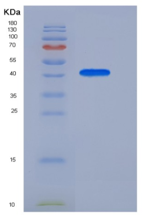 Recombinant Human APOA4 Protein (His Tag),Recombinant Human APOA4 Protein (His Tag)