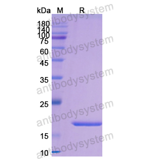 重組CD7蛋白,Recombinant Human CD7, N-His