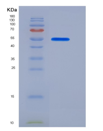 Recombinant Human PLTP Protein (His tag),Recombinant Human PLTP Protein (His tag)