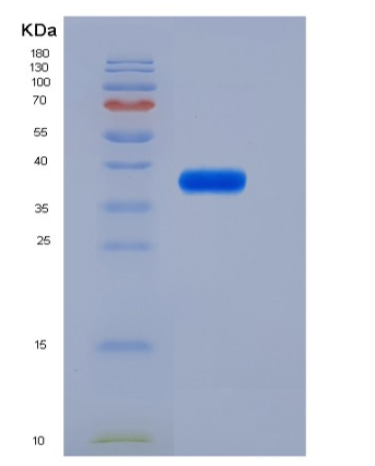 Recombinant Mouse IL6RA / CD126 Protein (His tag),Recombinant Mouse IL6RA / CD126 Protein (His tag)