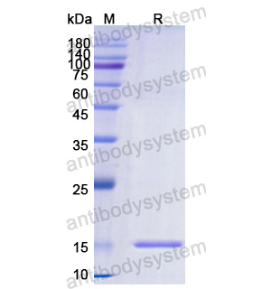 重組HMOX1蛋白,Recombinant Human HMOX1, N-His