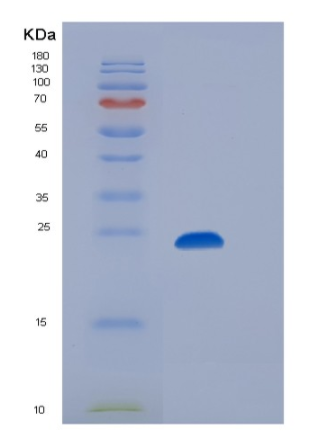 Recombinant Human CD32b / FCGR2B Protein (His & AVI tag),Recombinant Human CD32b / FCGR2B Protein (His & AVI tag)