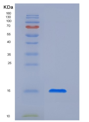 Recombinant Human CTLA4 / CD152 Protein (His tag),Recombinant Human CTLA4 / CD152 Protein (His tag)