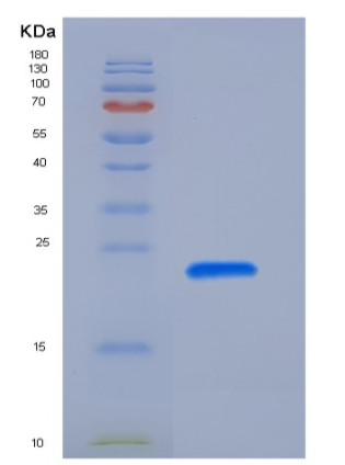 Recombinant Rat PRL2A1 / Prolactin-2A1 Protein (His Tag),Recombinant Rat PRL2A1 / Prolactin-2A1 Protein (His Tag)