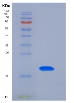 Recombinant Mouse TFPI2 / PP5 Protein (His tag),Recombinant Mouse TFPI2 / PP5 Protein (His tag)