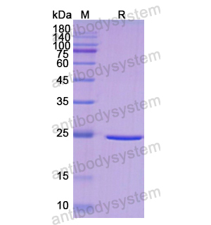 重組DLD蛋白,Recombinant Human DLD, N-His