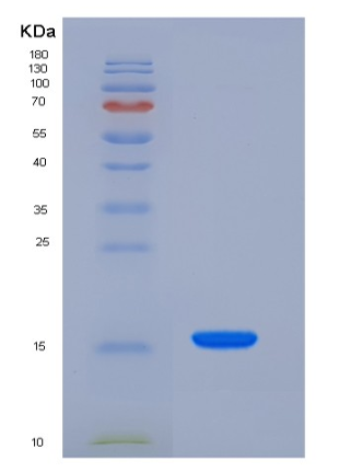 Recombinant Rat Niemann-Pick disease type C2 / NPC2 Protein (His Tag),Recombinant Rat Niemann-Pick disease type C2 / NPC2 Protein (His Tag)
