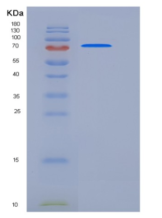 Recombinant Mouse ADAM15 / MDC15 Protein (His tag),Recombinant Mouse ADAM15 / MDC15 Protein (His tag)