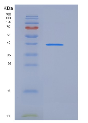 Recombinant Human sFRP4 Protein (His tag),Recombinant Human sFRP4 Protein (His tag)