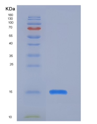 Recombinant Human SAP Protein (His Tag),Recombinant Human SAP Protein (His Tag)