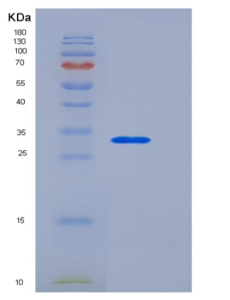 Recombinant Human Beta-amyloid 39 / Beta-APP39 Protein (aa 672-710, His & GST tag),Recombinant Human Beta-amyloid 39 / Beta-APP39 Protein (aa 672-710, His & GST tag)