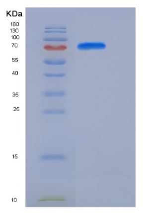 Recombinant Mouse MFI2 / CD228 / melanotransferrin Protein (His tag),Recombinant Mouse MFI2 / CD228 / melanotransferrin Protein (His tag)