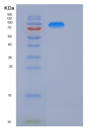 Recombinant Human KIAA1279 Protein (His & GST tag),Recombinant Human KIAA1279 Protein (His & GST tag)