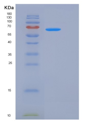 Recombinant Rat EphA3 Protein (His tag),Recombinant Rat EphA3 Protein (His tag)