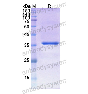 重组CTSH蛋白,Recombinant Human CTSH, N-His