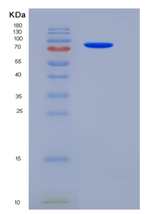 Recombinant Rat EphA3 Protein (Fc tag),Recombinant Rat EphA3 Protein (Fc tag)