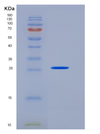 Recombinant Human Carbonic Anhydrase X / CA10 Protein,Recombinant Human Carbonic Anhydrase X / CA10 Protein