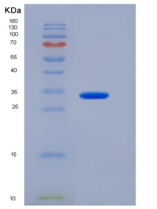 Recombinant Human IMP1 / IMPA1 Protein (His tag),Recombinant Human IMP1 / IMPA1 Protein (His tag)