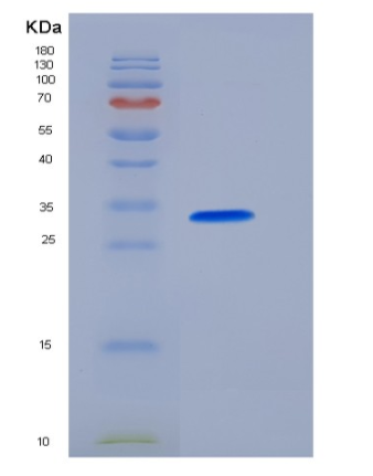 Recombinant Human Carbonic Anhydrase VII / CA7 Protein (His tag),Recombinant Human Carbonic Anhydrase VII / CA7 Protein (His tag)