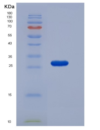 Recombinant Mouse RPE / RPE2-1 Protein (His tag),Recombinant Mouse RPE / RPE2-1 Protein (His tag)