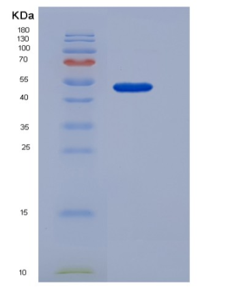 Recombinant Mouse COLEC10 Protein (Fc tag),Recombinant Mouse COLEC10 Protein (Fc tag)