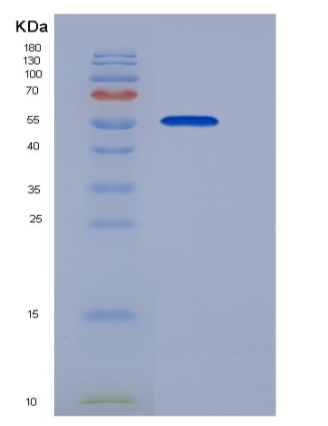 Recombinant Human S100A3 / S100E Protein (His & MBP tag),Recombinant Human S100A3 / S100E Protein (His & MBP tag)