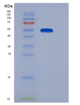 Recombinant Human EDEM2 / C20orf31 Protein (His tag),Recombinant Human EDEM2 / C20orf31 Protein (His tag)