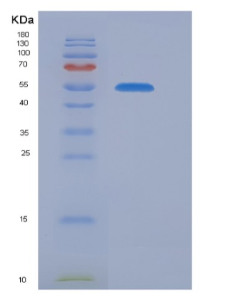 Recombinant Mouse CNDP2 Protein (His Tag),Recombinant Mouse CNDP2 Protein (His Tag)