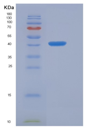 Recombinant Human Frizzled-6 / FZD6 Protein (Fc tag),Recombinant Human Frizzled-6 / FZD6 Protein (Fc tag)