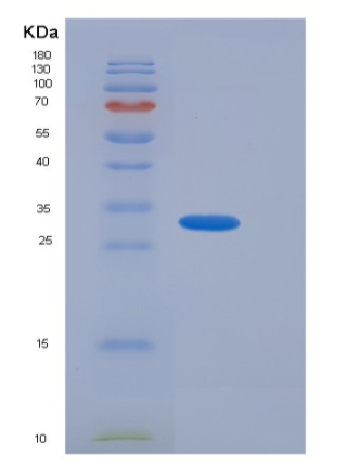 Recombinant Human ACBD6 Protein (His tag),Recombinant Human ACBD6 Protein (His tag)