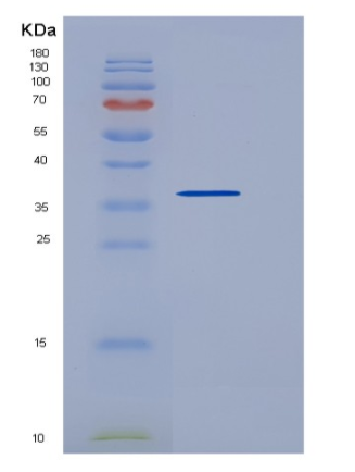 Recombinant Human TSPAN8 / Tetraspanin 8 / TM4SF3 Protein (Fc tag),Recombinant Human TSPAN8 / Tetraspanin 8 / TM4SF3 Protein (Fc tag)