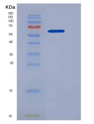 Recombinant Human LSAMP Protein (Fc tag),Recombinant Human LSAMP Protein (Fc tag)