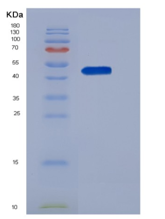 Recombinant Human SerpinI1 / Neuroserpin Protein (His tag),Recombinant Human SerpinI1 / Neuroserpin Protein (His tag)