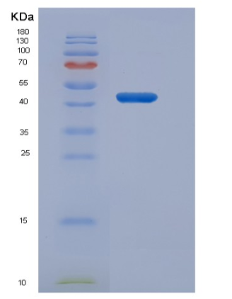 Recombinant Human Gastric lipase / LIPF Protein (His tag),Recombinant Human Gastric lipase / LIPF Protein (His tag)