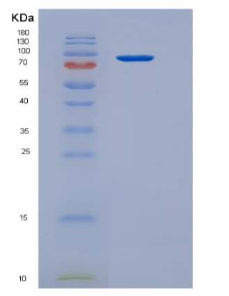 Recombinant Human BBOX1 / Gamma-BBH Protein (His & GST tag),Recombinant Human BBOX1 / Gamma-BBH Protein (His & GST tag)